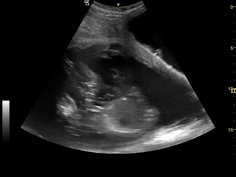 Ultrasound of Mylo